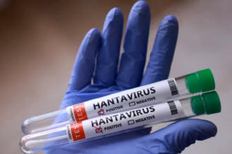 Hantavirus Risk in Thailand Remains Very Low