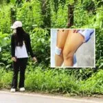 Nurse Atttack Chiang Rai