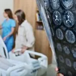 New Alzheimers Treatment Trials